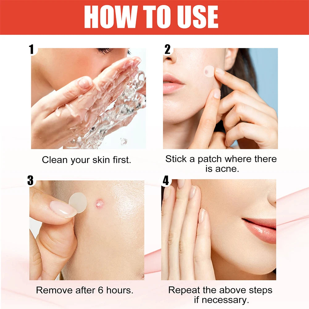 Hydrocolloid Acne Patch Invisible Closed Acne Patch Invisible Acne Face Invisible Waterproof Breathable Acne Skin Patch